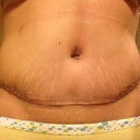 PO day 21 front