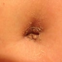 PO day 21 bb