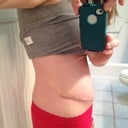 3 weeks post
