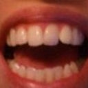 Before braces