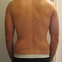 Pre-Procedure