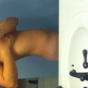 Week and a half after smartlipo