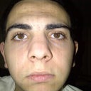 Day before my Surgery 12/21