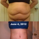 The night before my TT and 2 weeks Post Op
it makes me tear up knowing I have a body I am no longer ashamed of!
