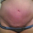 4 weeks post op
