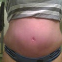 4 weeks post op, sides are still swollen
