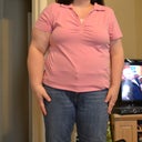 front Post op day 18. Very Happy