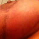 Right side