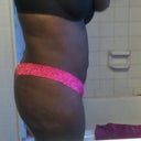 27 days post op right