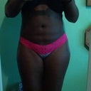 27 days post op front