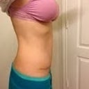 Almost 9wks po. Love this side!!!
