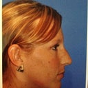 Here's a side view taken at the doctor's office