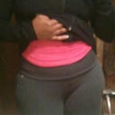 view of my hips after 7wks tt