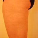 Before - left side