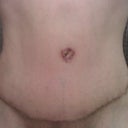 22 days after revision.
