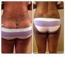 Before and after