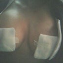 day after surgery my left boob has already started to drop.