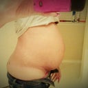 Before tummy tuck....