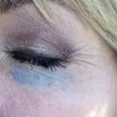 April 12, 2012 Black Eye right after appointment.