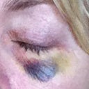 April 19, 2012
Aproximately 1 week later