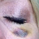 April 29, 2012
Approximately 3 weeks later