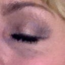 May 12, 2012
Approximately 4 weeks later.
Covered with Makeup but still visable.