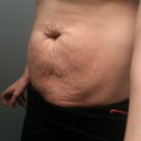 Not Sucking in the Tummy:)