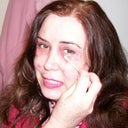 Day 4.  Beyond the pain, I do feel pretty and can see improvement.