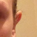 Left ear