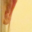Right ear