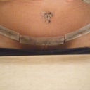 Incision and BB. Please excuse the garden. :)