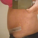 Side view...a little swollen.