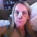 Day 4 post op