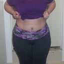 Really super swollen post op day 20