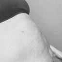Big Belly/Stretch Marks (2)