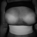 4 days post op