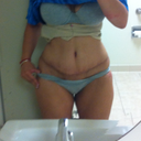 4 weeks post op feeling great