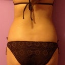 Back - Before