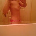 5wks post op
