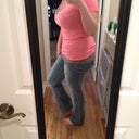 Day 10 post op. flat tummy! Still swollen though
