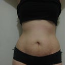 4 weeks after