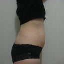 4 weeks after