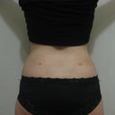 4 weeks after