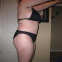 6 weeks post-op