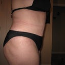 6 weeks Post-Op