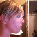 Nose profile before
