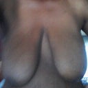 Before surgery (front)