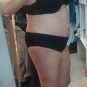 Right side, less bruising