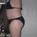 4 week post op