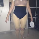 Day 10 Me from the front 2 (keep in mind I am still swollen)